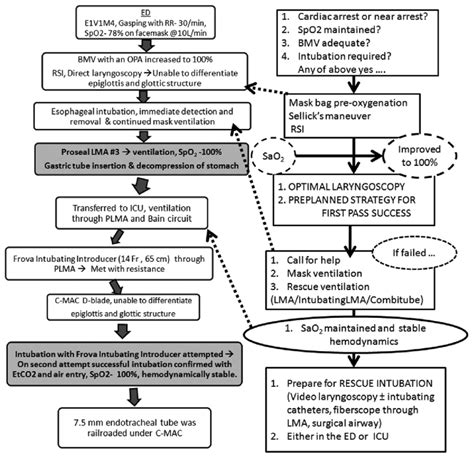 Image result for Difficult Airway Algorithm