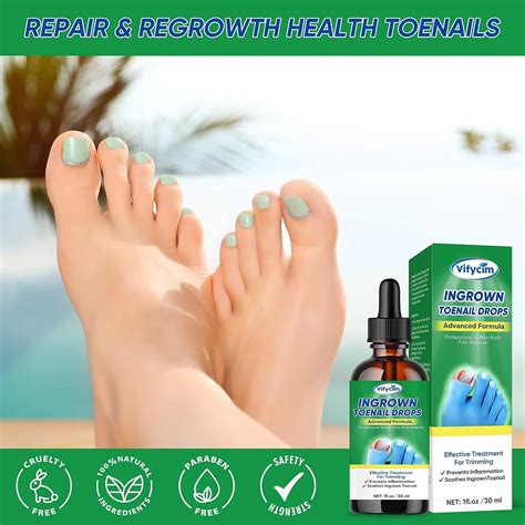 Ingrown Toenail Treatment Drops - Fast Acting Pain Relief & Softener 30ml | Buy Now with Express ...