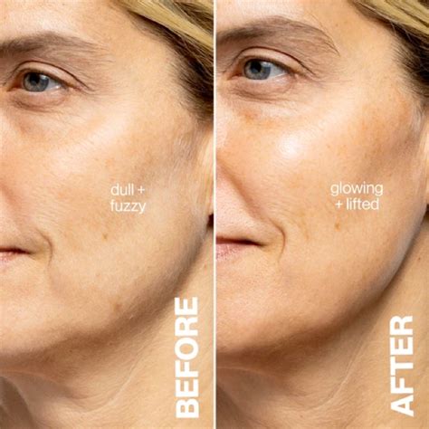 How to Use DermaFlash 的图像结果