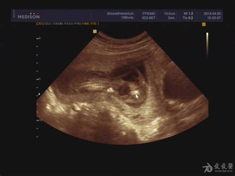 孕17周胎儿大小-有来医生