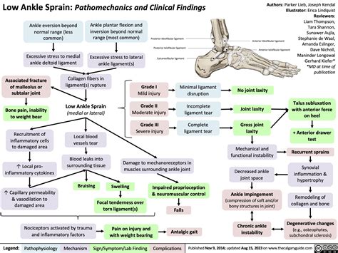 Low Ankle Sprain: Pathomechanics and Clinical Findings | Calgary GuideCalgary Guide