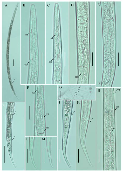 New Records of Ditylenchus Species from Southern Alberta, Canada