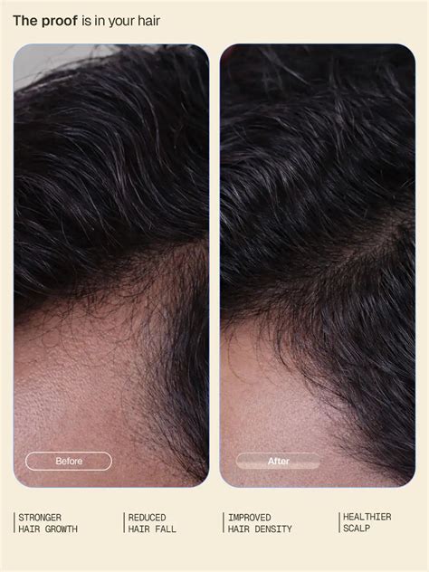 Arata Hair Growth Intensive Serum - Pack of 3