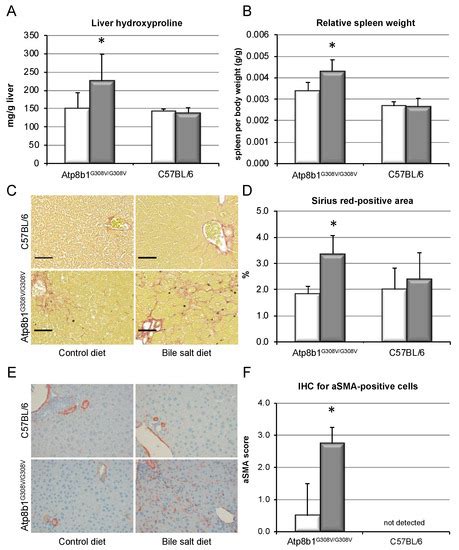Glycochenodeoxycholate Promotes Liver Fibrosis in Mice with ...