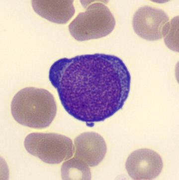 Image result for Lymphocytes Microscopic View