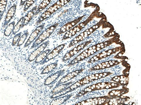 Cytokeratin 19 antibody (60187-1-Ig) | Proteintech