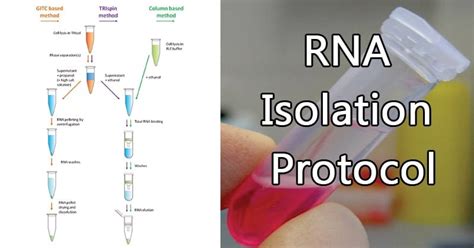 Isolation of RNA From Bacteria 的图像结果