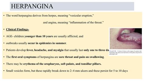 Vesiculobullous lesion of oral cavity.pptx