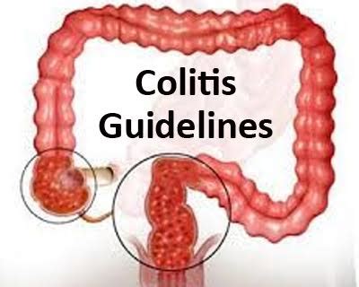 Medical management of microscopic colitis: American Gastroenterological ...