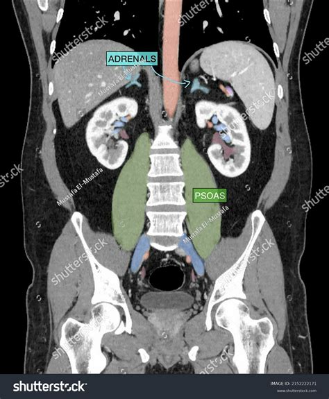 CT Scan 的图像结果