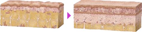 FatX Core（ファットエックス コア）｜医療ダイエット・部分瘦せなら湘南美容クリニック【公式】