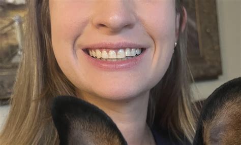 What can I do to fix my smile? : r/Teethcare