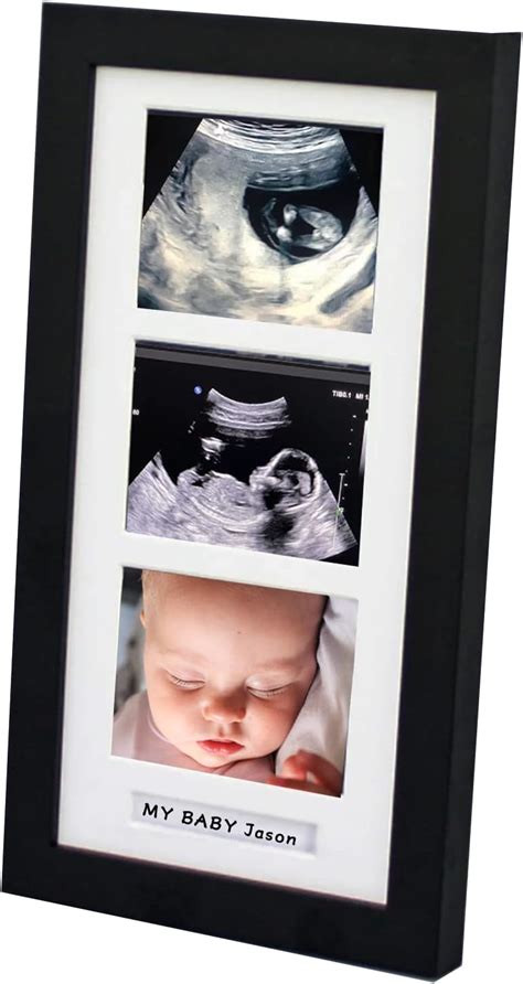 Trlry Triple Ultrasound Picture Frames, Sonogram Picture India | Ubuy