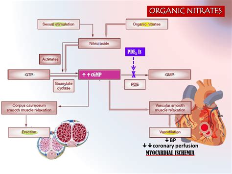 PPT - HEART ATTACK PowerPoint Presentation, free download - ID:1174565