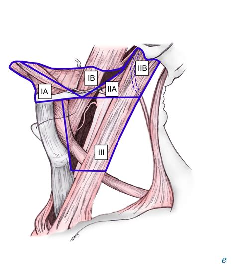 Neck Dissection Classification: Overview, Relevant Anatomy, Classification of Neck Dissections ...