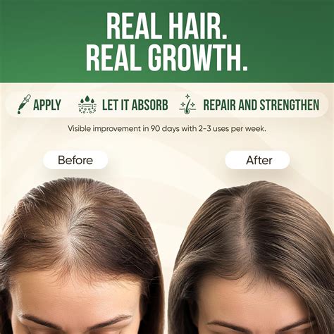 Morstar Batana Oil for Hair Growth - Dr Sebi Batana India | Ubuy