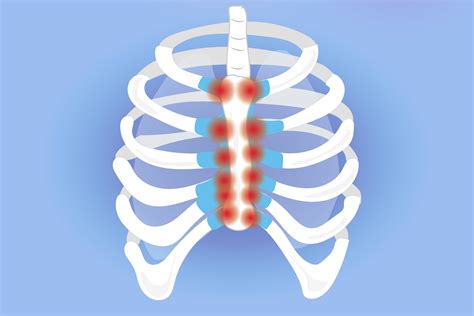 Xiphoid Process Cancer Symptoms