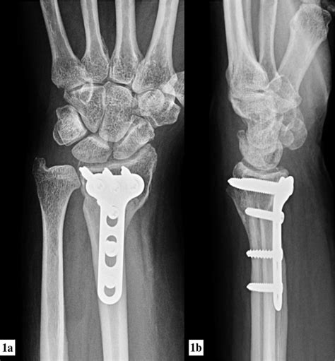 Image result for Examples of 6O2