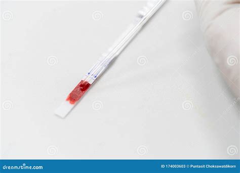Hepatitis B Surface Antigen HBsAg Test Strip is a Rapid, Qualitative ...