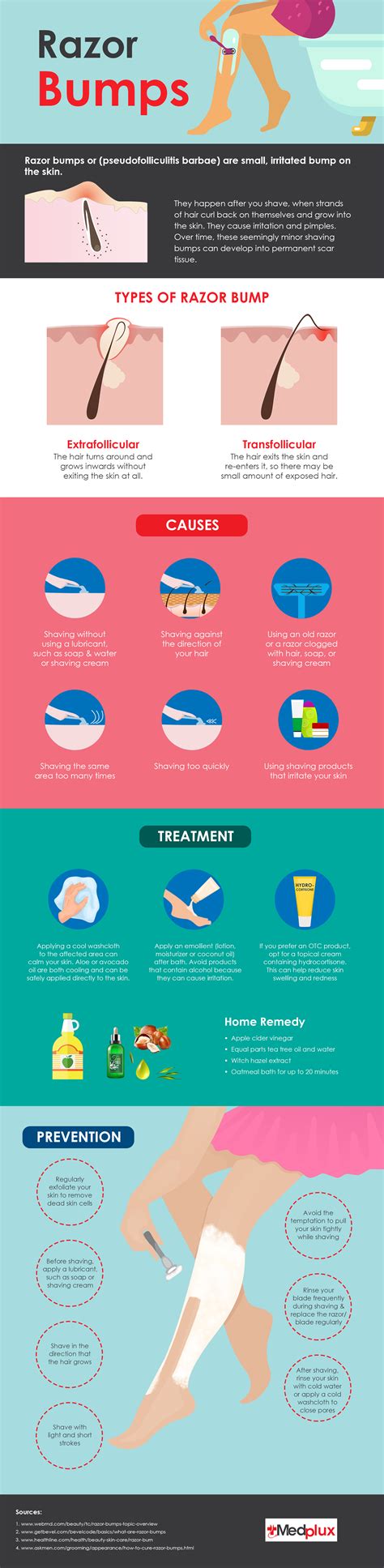 How To Avoid Razor Bumps