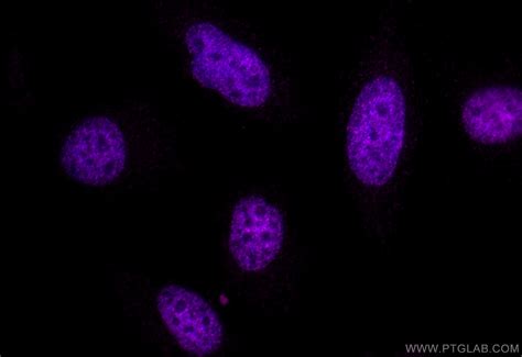 Acetyl-Histone H3 (Lys4) antibody (CL647-84831) | Proteintech