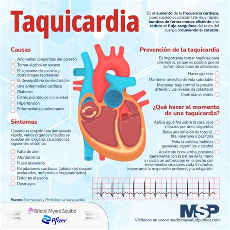 Taquicardia: Qué Es, Síntomas, Tipos Y Cómo Quitar – GCGQ