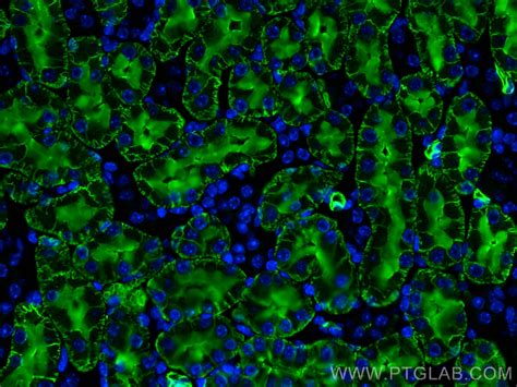AQP1 antibody (20333-1-AP) | Proteintech