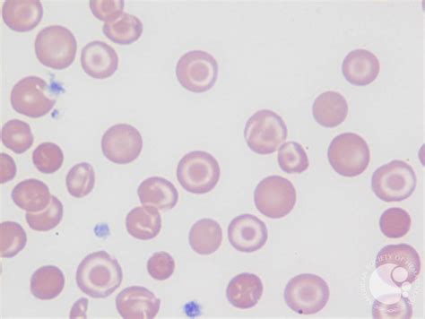 Target Cells