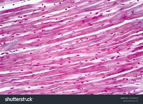 Cardiac Muscle Slide Labeled