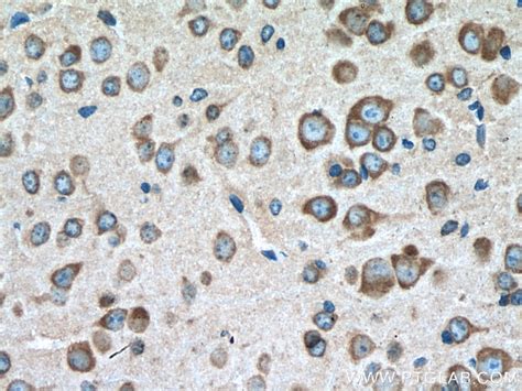 VPS26B antibody (15915-1-AP) | Proteintech