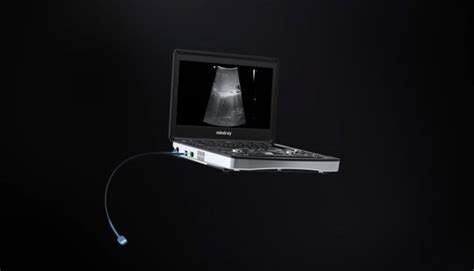 UX5 Series 4K/NIR - Endoscope Camera System - Mindray India