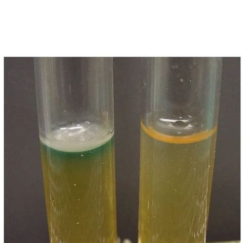Sewage Treatment Chemicals - Activated Carbon Granules Trader ...