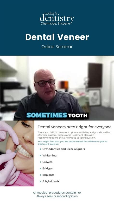 Alternatives to dental veneers – Artofit