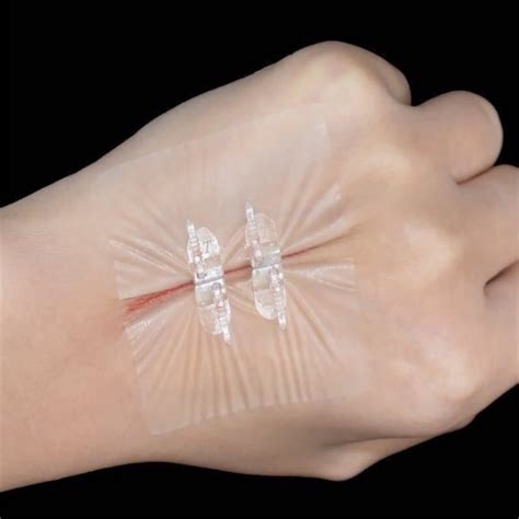 Buy 2PCbox Bandage Band Aid Zip Stitches Zip Tie Wound Closure Adhesive ...