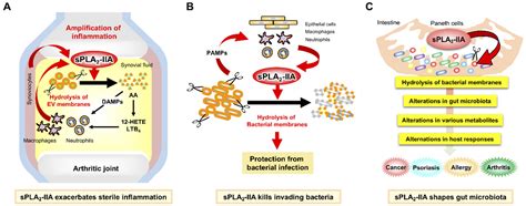 Old but New: Group IIA Phospholipase A2 as a Modulator of Gut Microbiota