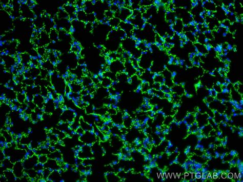 Integrin alpha-8 antibody (30714-1-AP) | Proteintech
