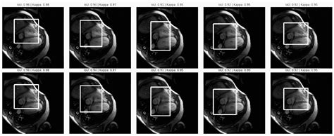 Mitigating Algorithmic Bias in AI-Driven Cardiovascular Imaging for ...