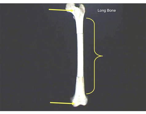 Parts of Long Bone Quiz