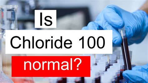 Is Chloride 100 normal, high or low? What does Chloride level 100 mean?