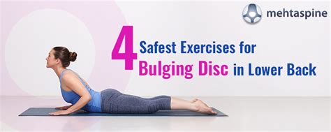 Image result for Exercise for Bulging Disk