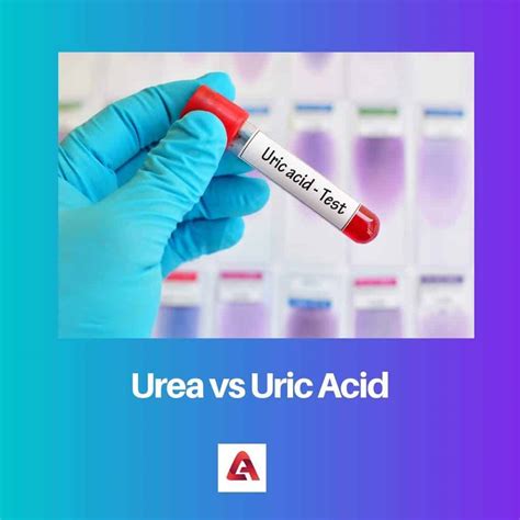Difference Between Urea And Thiourea at Maria Kring blog
