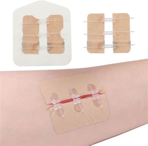 Amazon.com: RHINO RESCUE Wound Closure Kit, 6pcs with Dresssings, Wound ...