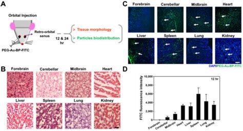 Improved Delivery Performance of n-Butylidenephthalide-Polyethylene ...