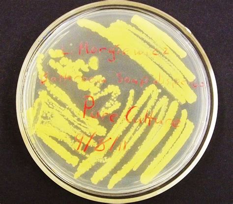 MicrobeDiscoveries: Taking a Pure Culture from the Environmental Samples