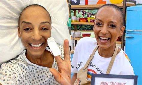 Adele Roberts reveals cancer treatment during Celebrity Bake Off