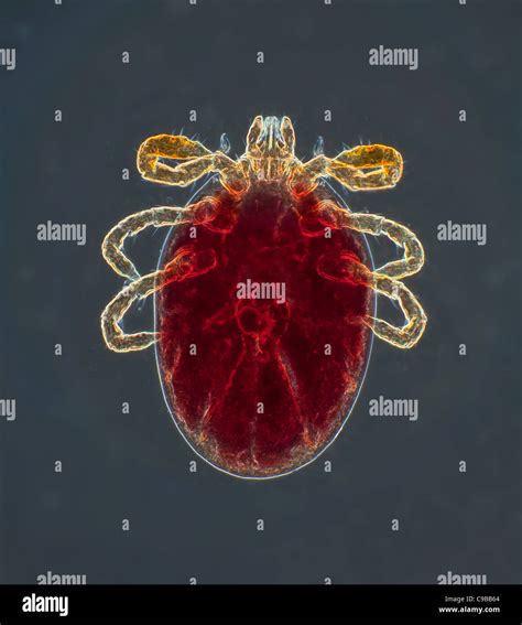 Dermacentor Variabilis Slide