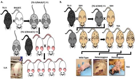 Glutamatergic Signaling a Therapeutic Vulnerability in Melanoma