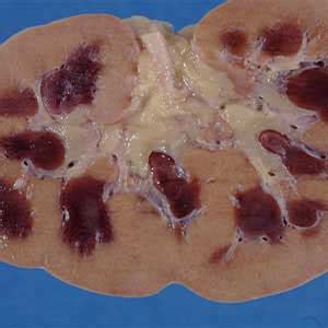 Nephrologist in Anantapur | Kidney specialist in Anantapur | Dr. M ...
