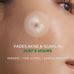 Shop Self Dissolving Microneedle Acne Patches | 8 Patches for Healthy ...