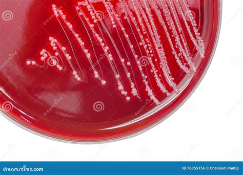 Streptococcus Bacterial Colonies with Beta Hemolytic on Blood Ag Stock ...